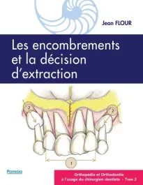 Orthopédie et orthodontie à l&rsquo;usage du chirurgien-dentiste. Tome 2, Les encombrements et la décision